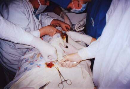 Реферат: Ранние послеоперационные осложнения в сосудистой хирургии